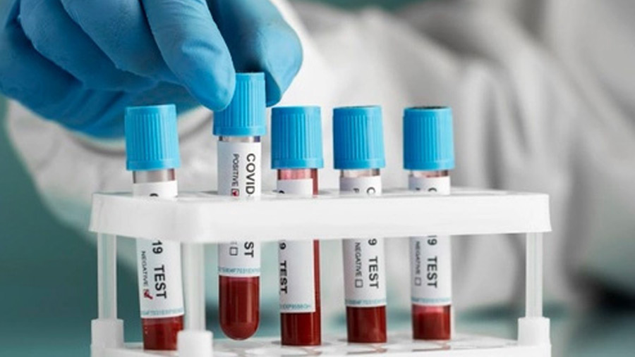 13 more Covid-19 cases reported in the country